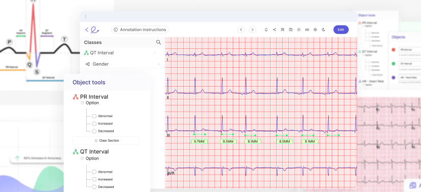 AI ECG Interpretation